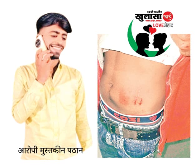 प्रेम प्रसंग में चाकूबाजी, एक घायल