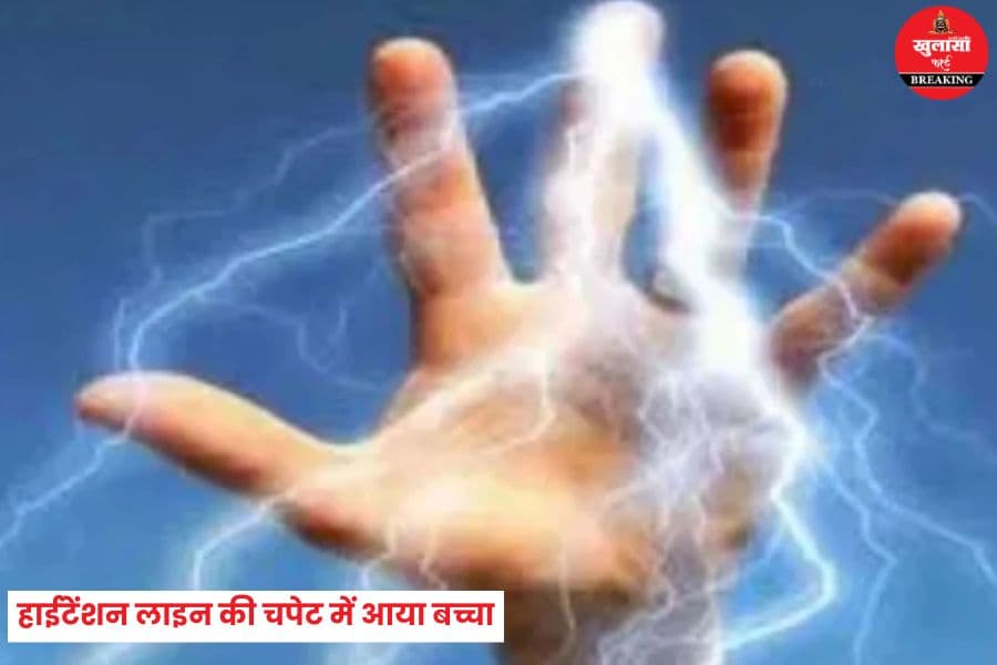 हाईटेंशन लाइन की चपेट में आया 12 साल का बच्चा