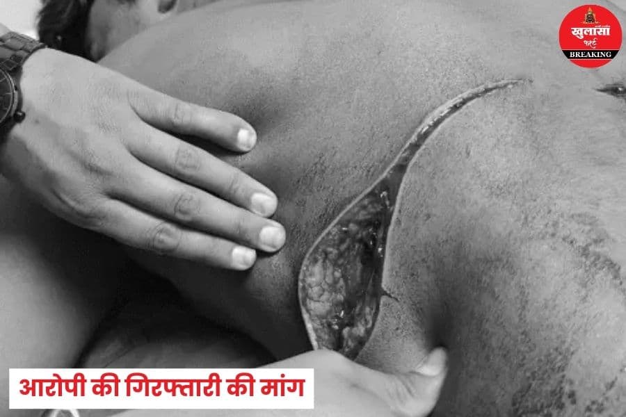 नशेड़ियों ने नाबालिग का यह क्या हाल कर दिया