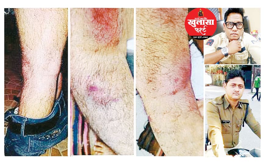 लाठी, लूट और लापरवाही