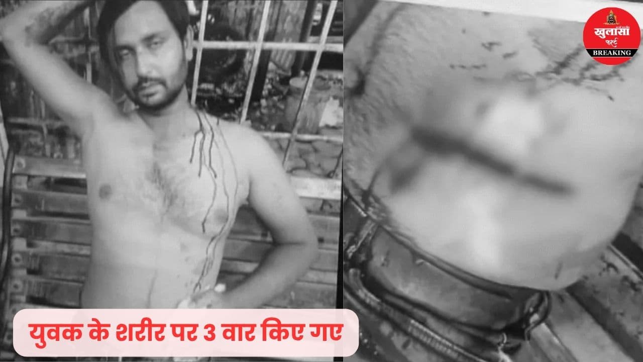 घूरने के विवाद पर युवक पर चाकू से हमला