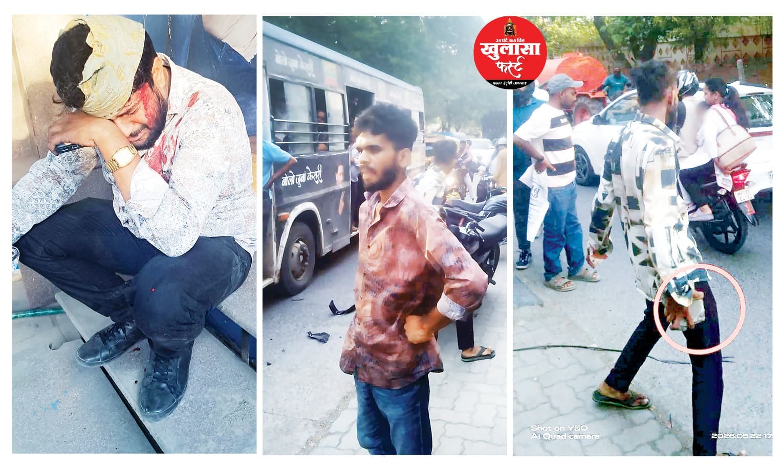 गाड़ी टच हुई तो कंजरों ने फोड़ डाला ब्लॉक और बोतल से सिर