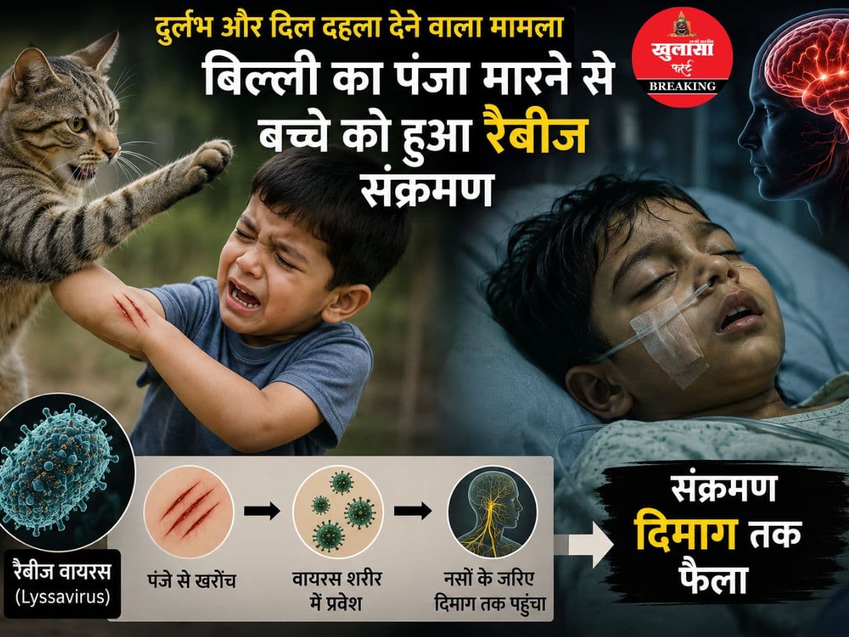 बिल्ली के पंजे से खरोंच से 13 वर्षीय बच्चे की जान गई