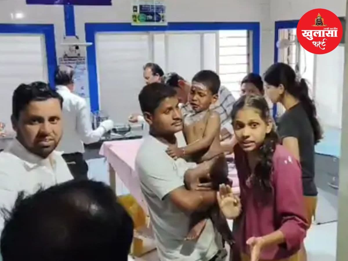 बाटी बनाते समय भड़की आग