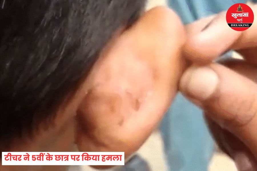 टीचर ने 5वीं के छात्र पर किया हमला