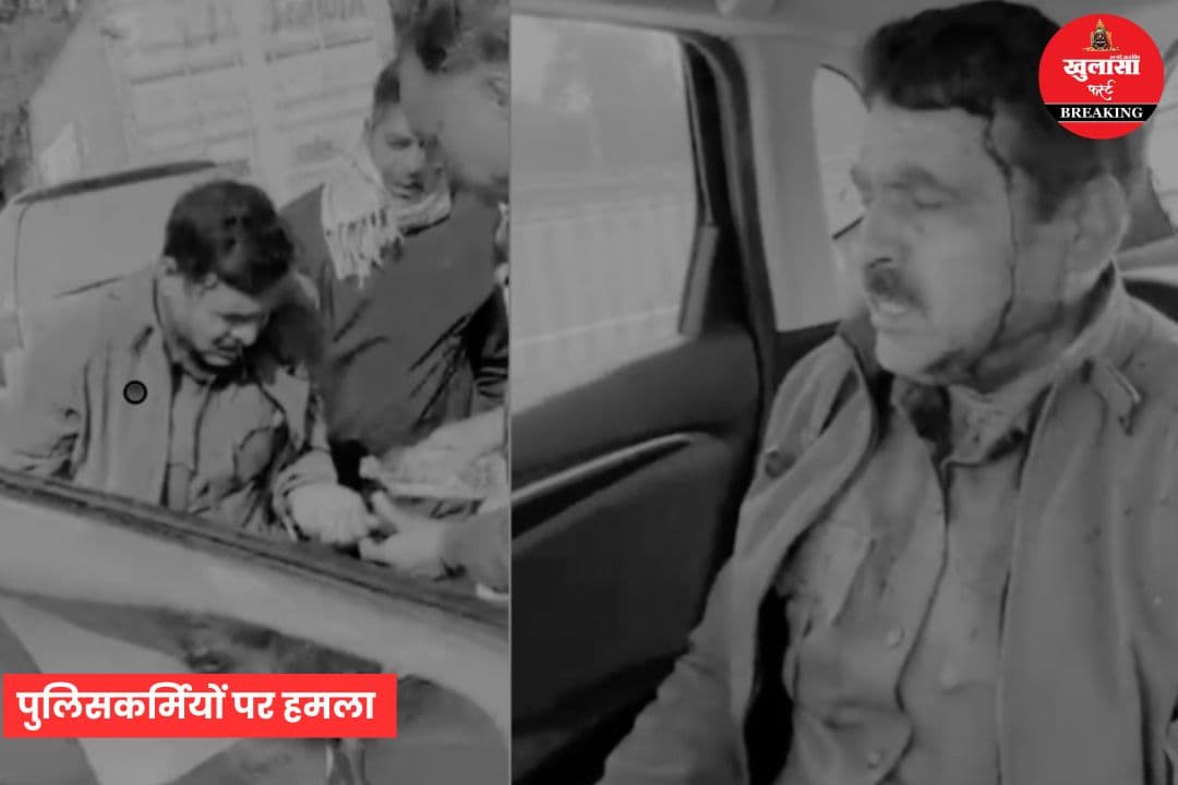पुलिस पर आंखों में मिर्च पाउडर डालकर हमला