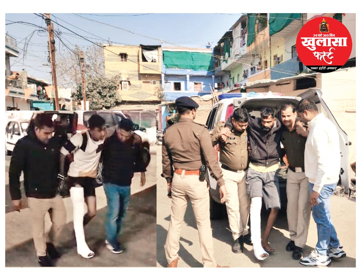 गुंडाराज चकनाचूर, 64 अपराधों से लदे बदमाश के हाथ-पैर टूटे
