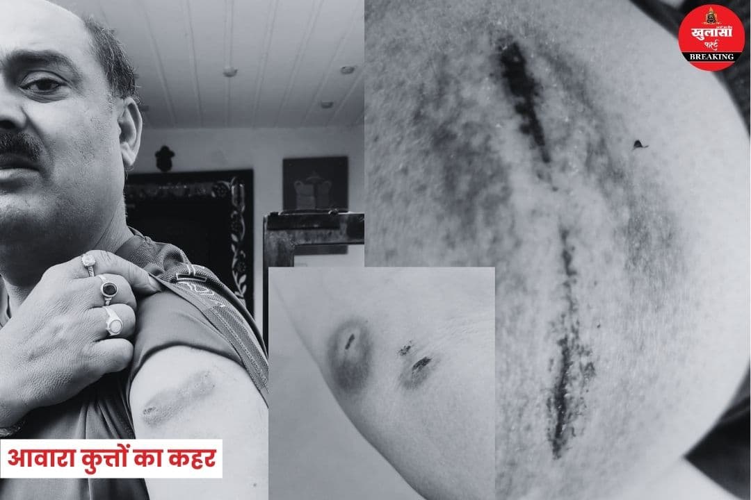 आवारा कुत्तों का कहर
