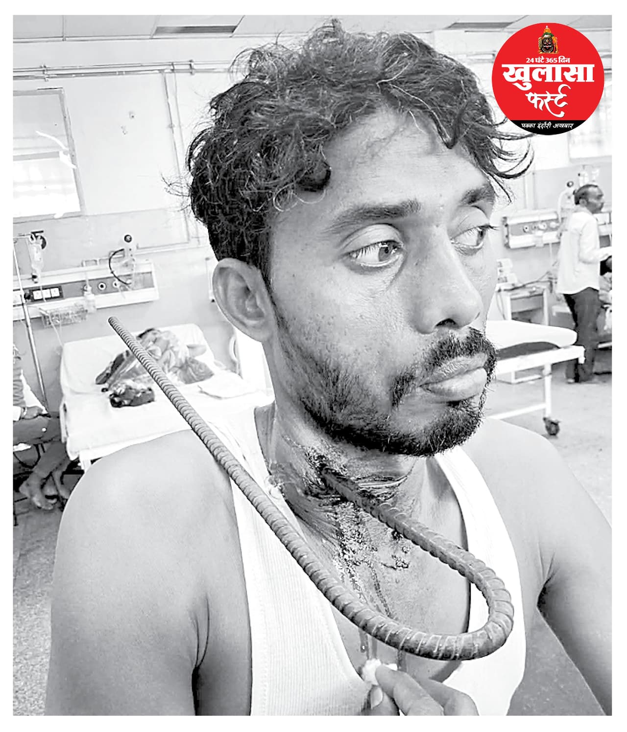 मिस्त्री के गले के आर-पार सरिया डॉक्टरों ने निकाला