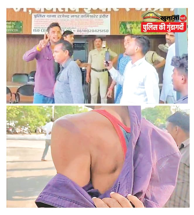 मंडी चौराहा पर वर्दी वाला बना गुंडा