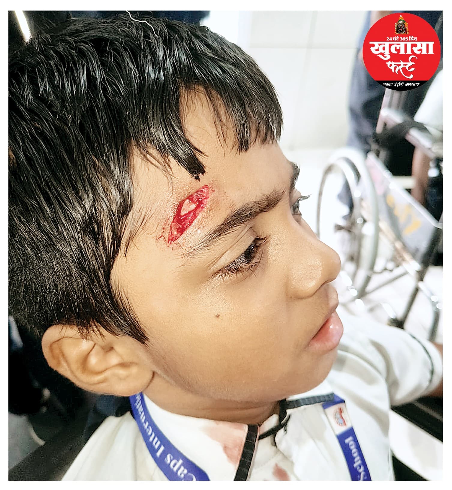 शिक्षिका का बेटा स्कूल में ही दूसरे छात्र से टकराया