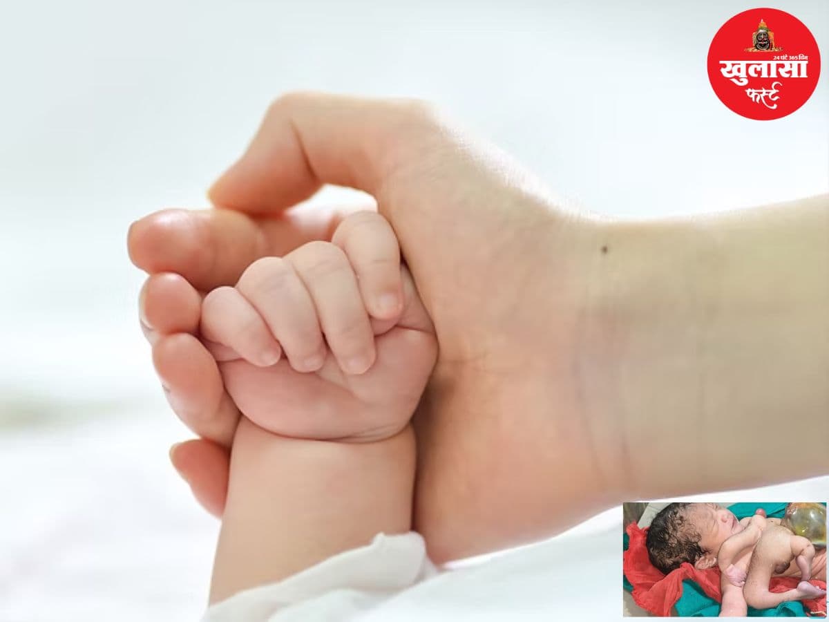 चार हाथ-पैर वाले बच्चे का हुआ जन्म