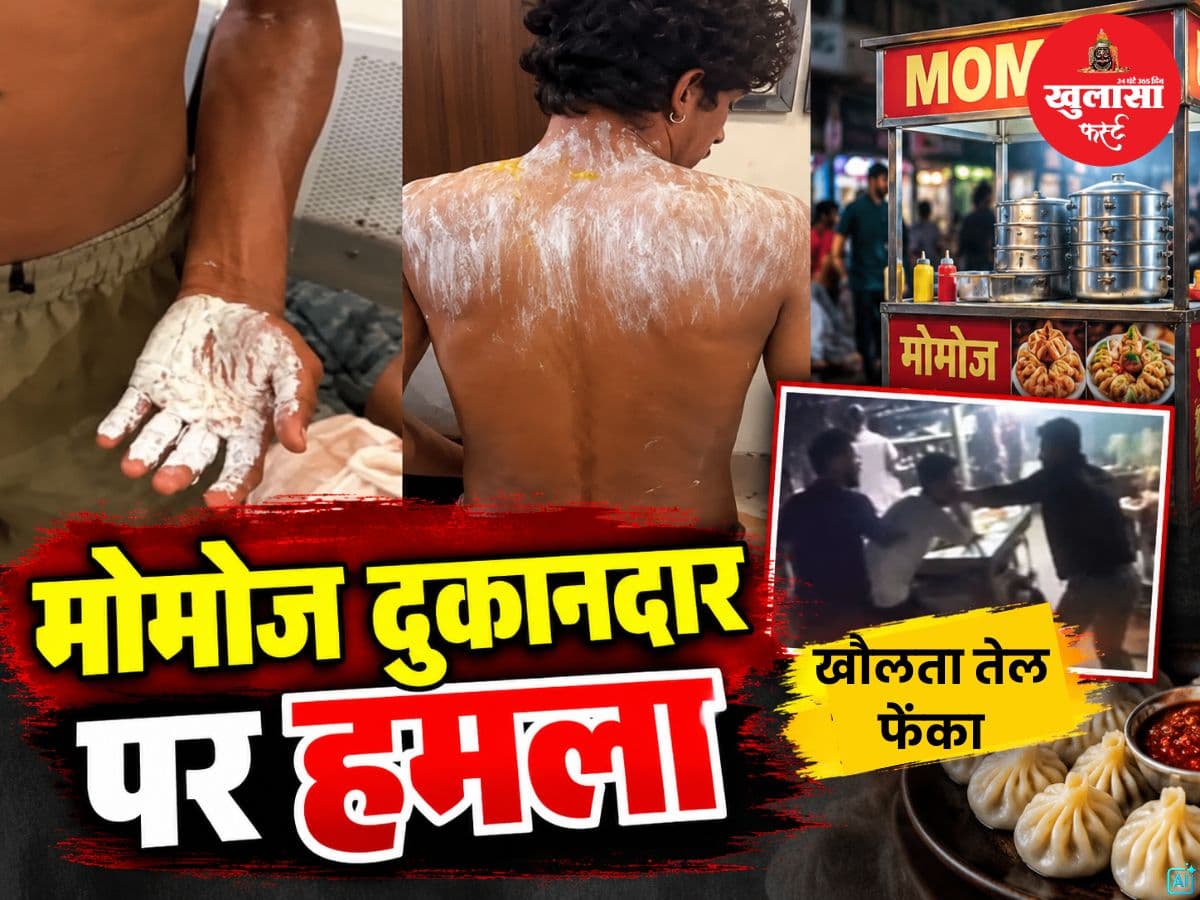 मोमोज दुकानदार पर हमला