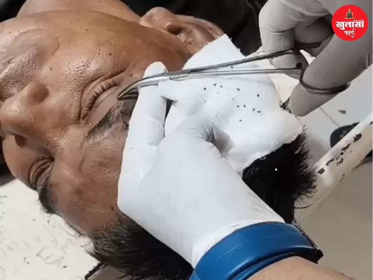 जवारा विसर्जन के दौरान मधुमक्खियों का हमला