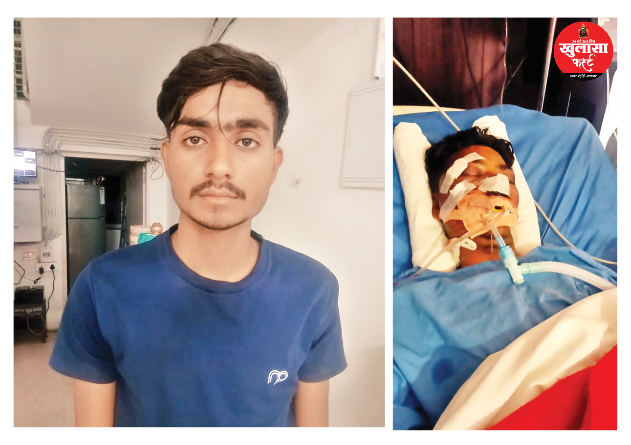 दूल्हे की कार की चाबी मांगने पर ईंट से हमला हत्या में बदला